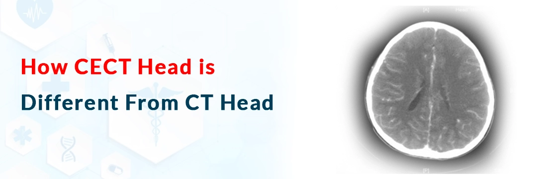 How CECT Head is Different From CT Head